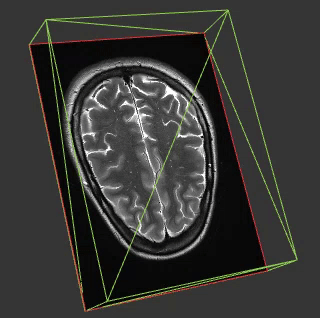 Brain imaging using AMI Medical Imaging (AMI) JS ToolKit